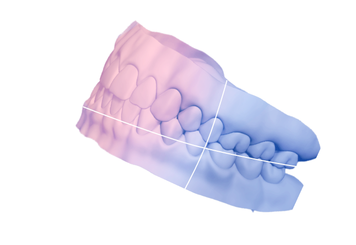 img-jaws-teeth-3d-scanner